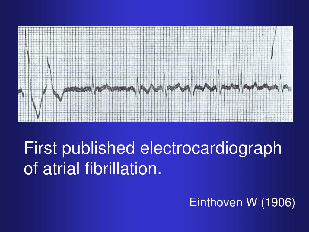 Den første EKG-registreringen av atrieflimmer
